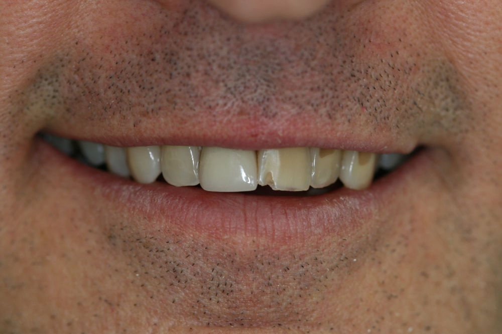 New Jersey oral restorations