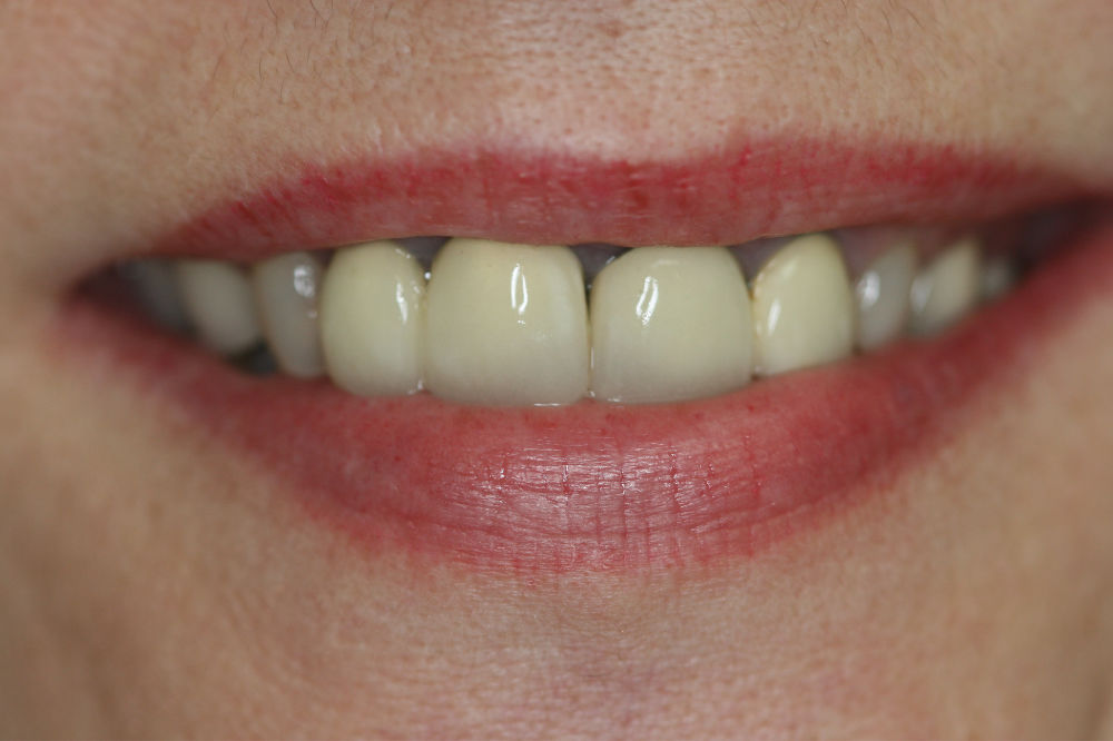 smile restorations NJ