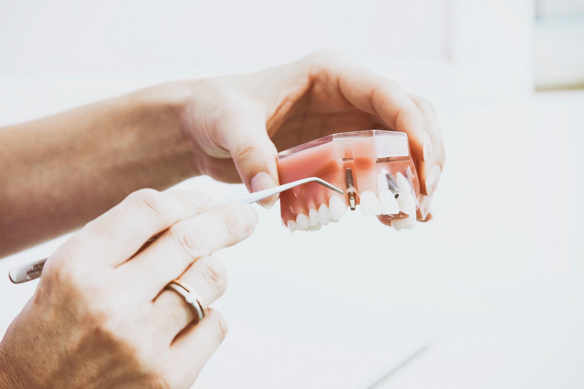 NJ Dental Implants