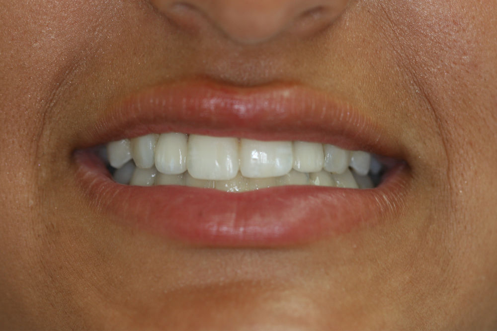 New Jersey Cosmetic Dentistry