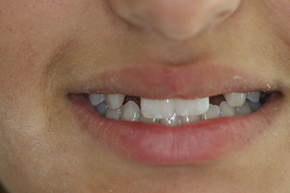 amanda-before-cosmetic-dental-treatment.jpg